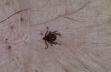a small tick embedded in the skin of a dog