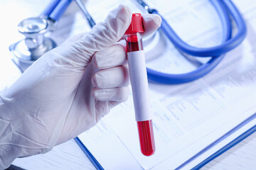 Laboratory worker holding test tube with blood sample and blank label over table, closeup. Medical...