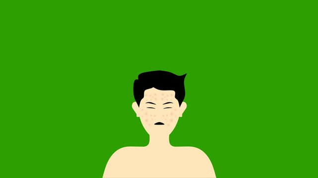 Illustration of a man's face full of smallpox. Simple animation on a green screen