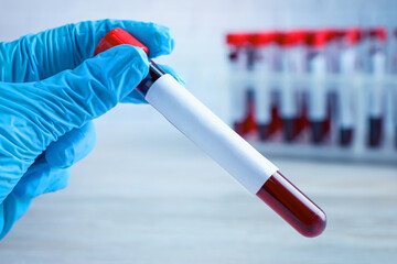 Laboratory worker holding test tube with blood sample and blank label over table, closeup. Medical...