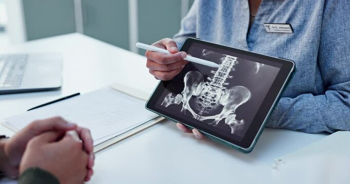 Healthcare, doctor and xray with tablet screen and hands for medical, report or treatment plan. Consultant, medicine or synthetic stem cell therapy with people and bone marrow transplant breakthrough