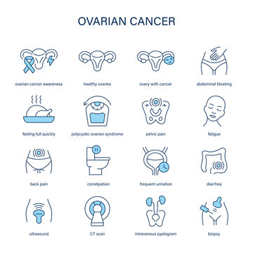 Ovarian Cancer symptoms, diagnostic and treatment vector icons. Medical icons.