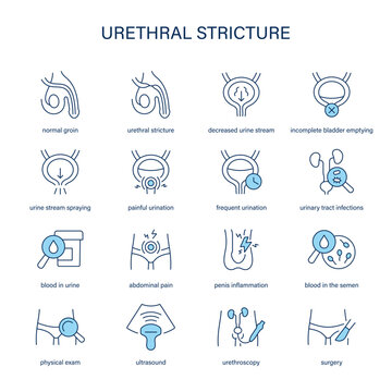 Urethral Stricture symptoms, diagnostic and treatment vector icons. Medical icons.	