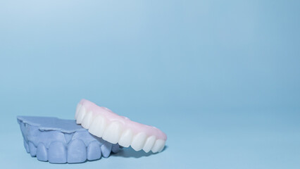 Dental Model and Denture on Blue Background