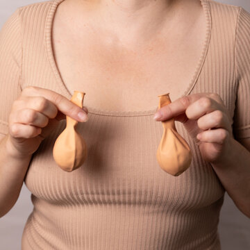 A woman holds deflated balloons demonstrating the concept of breast modification after feeding a baby and reaching age. High quality photo