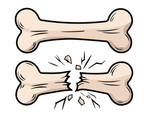 Broken or Fracture Bone. Human Trauma, Crack and Splinter. Vector illustration for Dog, Pet, Veterinary, and Bone-Related Designs