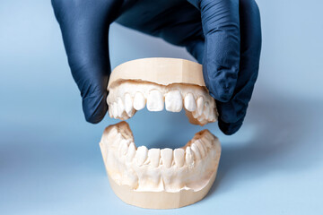 A gloved hand holds a dental plaster mold of teeth. The mold shows the upper and lower teeth in a natural position.