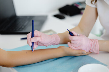 Doctor doing skin allergy test at white table in office. Allergy test - skin prick allergy testing...