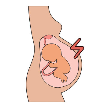 Preeclampsia symptoms and diagnostic vector icons. Pregnancy pregnant complications. Health and Medical icon illustration.