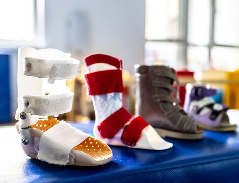 Various rehabilitation shoes and foot orthosis for children are showcased on a blue therapy table in a well-lit room designed for physical rehabilitation