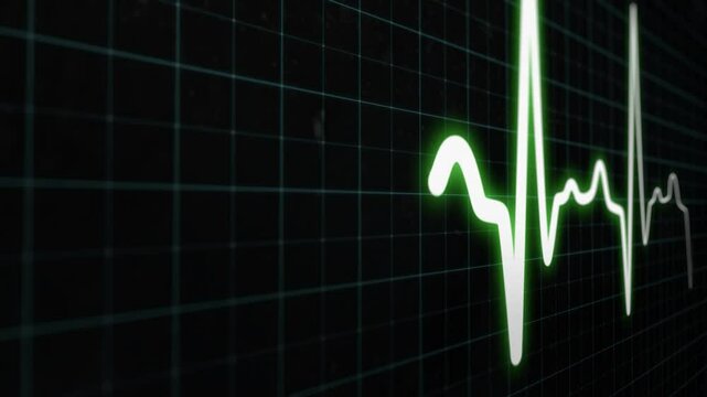 EKG ECG flatline. Heart beat line on monitor of electrocardiogram machine in extreme close-up, seamless loop