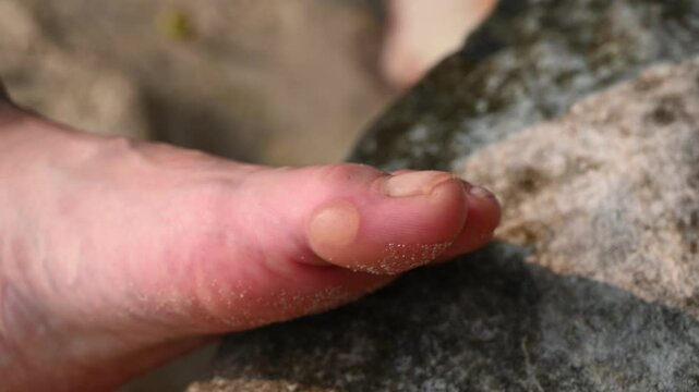 Closeup view of soft wet callus on a woman's foot on the beach