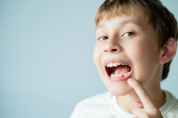 Change of milk teeth. 10 year old boy holds his face with his hand and shows his mouth. House.