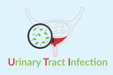 Urinary tract infection(UTI) vector. Illustration of infect the urinary tract. UTI with blue background