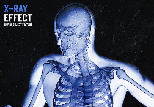 X-Ray Effect with Generative AI