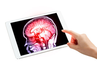 The tablet reveals high-resolution  detailed MRI MRA Brain scan sagtillal view isolated on white...