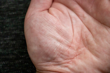Detailed view of the skin texture on the inner palm of a hand, showing patterns and lines.