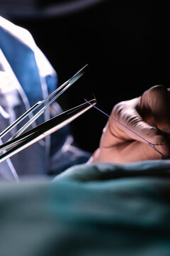 Close-up view of surgical instruments during operation