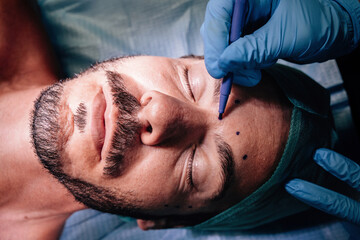 Marking the face in preparation for surgery