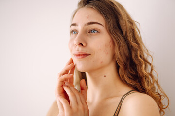 Fototapeta premium Beautiful young girl with problem skin. Young woman with wavy hair gently touching her face. Dermatology, cosmetology, skin care. Natural skin.