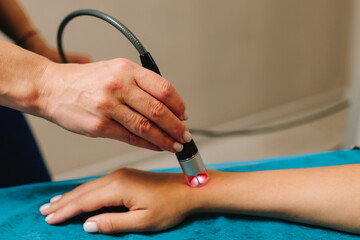 Hand low level laser therapy to promote healing of soft tissues. Infrared treatment of hand to...