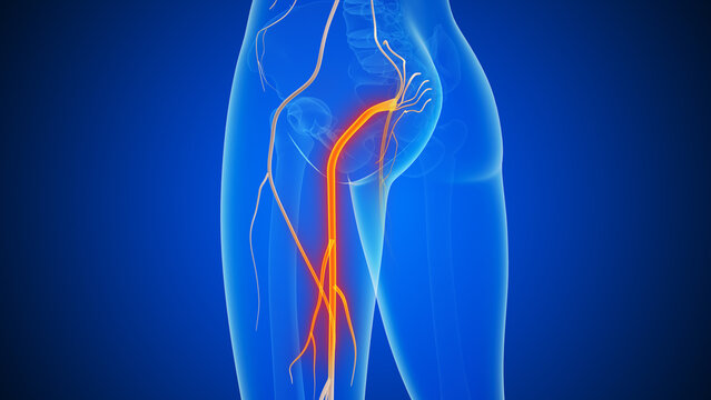 The medical concept of sciatic nerve pain