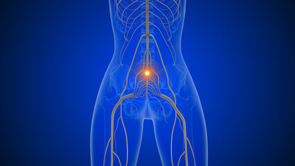 Sciatica causing lower back to leg discomfort