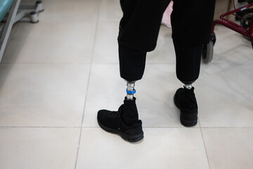 Person with prosthetic legs walking in rehabilitation center