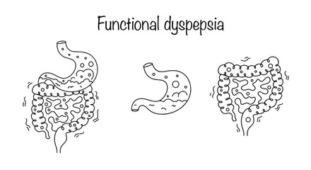 Functional dyspepsia