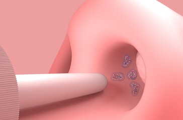 Epinephrine (adrenaline) nasal spray format - side view 3d illustration © LASZLO