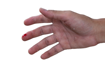 A man's hand was injured and bleeding due to accident isolated on white background included clipping path.