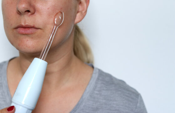 Close up of woman using a high frequency darsonval device on acne skin