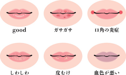 トラブルのある唇セット © MARI