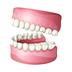 Model of a human teeth and gums for the upper and lower jaw