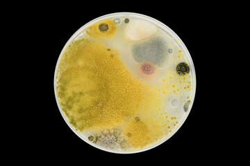 Yeast and mould test for hygiene . Personal hygiene. Yeast and mould in hair. Microbial load in...