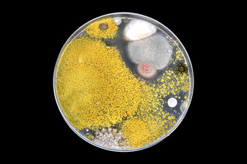 Yeast and mould test for hygiene . Personal hygiene. Yeast and mould in hair. Microbial load in...