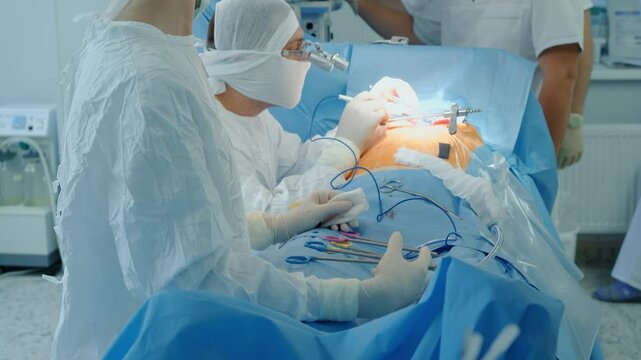 Surgeons team conducts heart surgery in clinic. Doctors operate patient with modern equipment during coronary artery bypass procedure in room