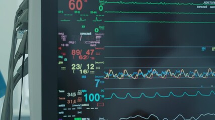 Monitor displays vital signs of patient. Modern equipment for continuously monitoring patient health ensuring safe condition in operating room