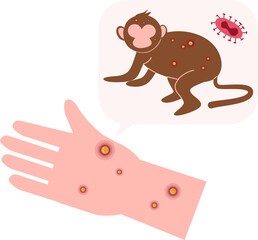 Monkeypox virus Illustration. Mpox virus.