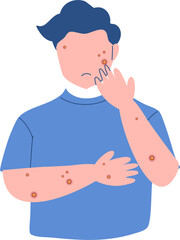 Monkeypox virus Illustration. Mpox virus.
