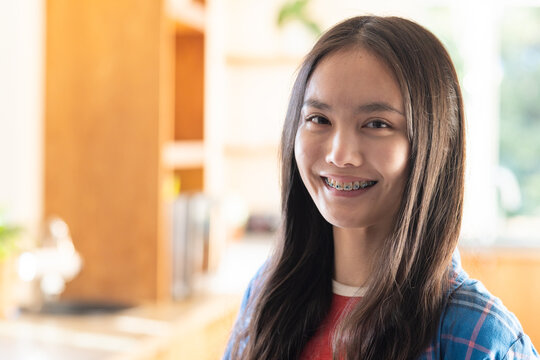 At home, Smiling young asian woman with braces standing in bright kitchen, looking at camera