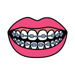 Vector illustration of pink lips with orthodontic braces