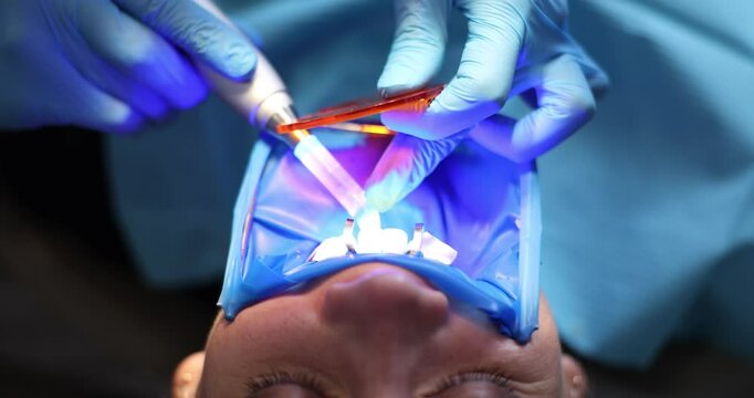 Woman undergoes teeth whitening with UV light in dental clinic. Dentist uses modern equipment taking care of patient in office slow motion