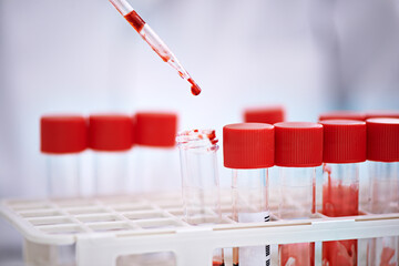Blood test, sample for science in laboratory, research and studying monkeypox virus, infection and...