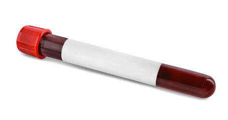 Blood in test tube with blank label on white background. Medical analysis