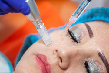 Application of an anti-aging facial rejuvenation cocktail using micro needles. Dermatology concept....