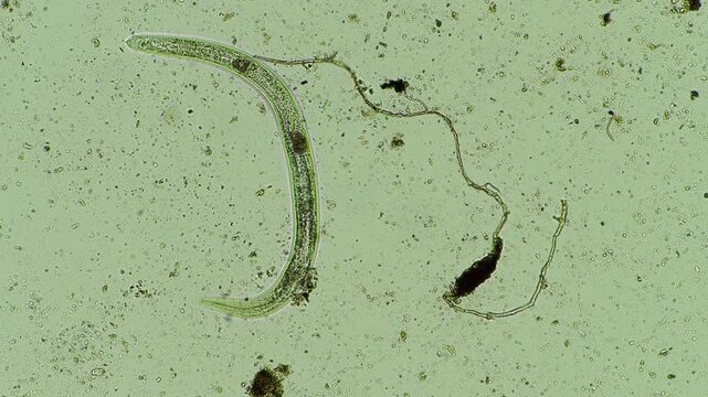 microorganisms and soil biology, with nematodes and fungi under the microscope. in a soil and compost sample