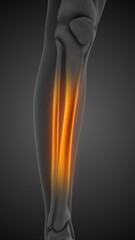 Chronic leg pain syndrome animation