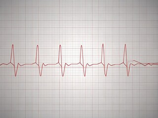 A minimalist yet highly detailed illustration of ECG limb leads on a light gray background, focusing on the simplicity and elegance of the design, with thin lines, gentle curves