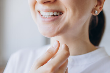 Woman Is Smiling Showing Her Invisalign Braces For Teeth Straightening And Whitening. New Technology For Teeth Straightening. Dental Health Medical Care Concept.